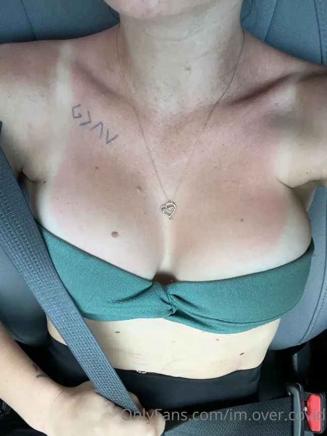 im.over.covid OnlyFans Leaked